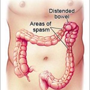 Insoluble Fiber And Ibs - How To Avoid Irratable Bowel Syndrome And Stress